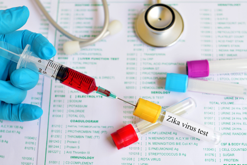 image of Zika virus testing