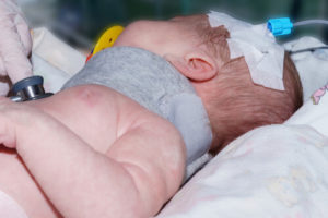 A newborn in the hospital getting treatment for a birth injury in Bethesda, Maryland. 