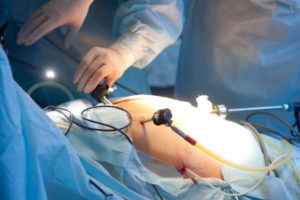 A man having surgery on his bile duct injury in Washington, D.C.