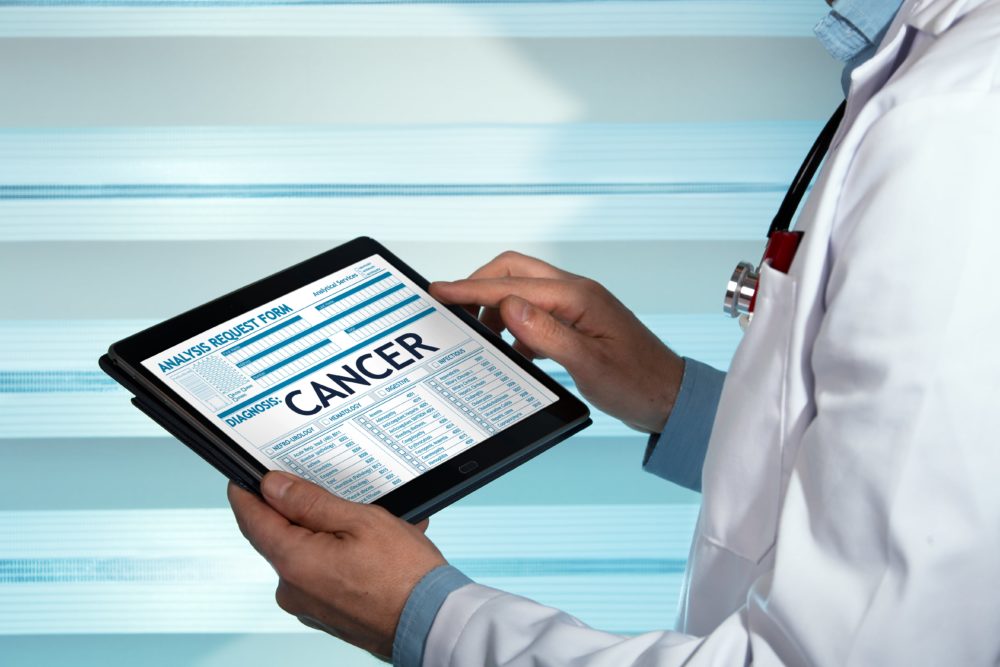 Physician holding tablet showing cancer results.