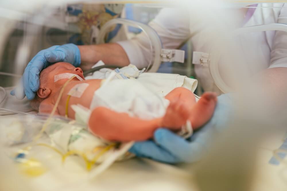 Newborn baby in the neonatal intensive care unit.