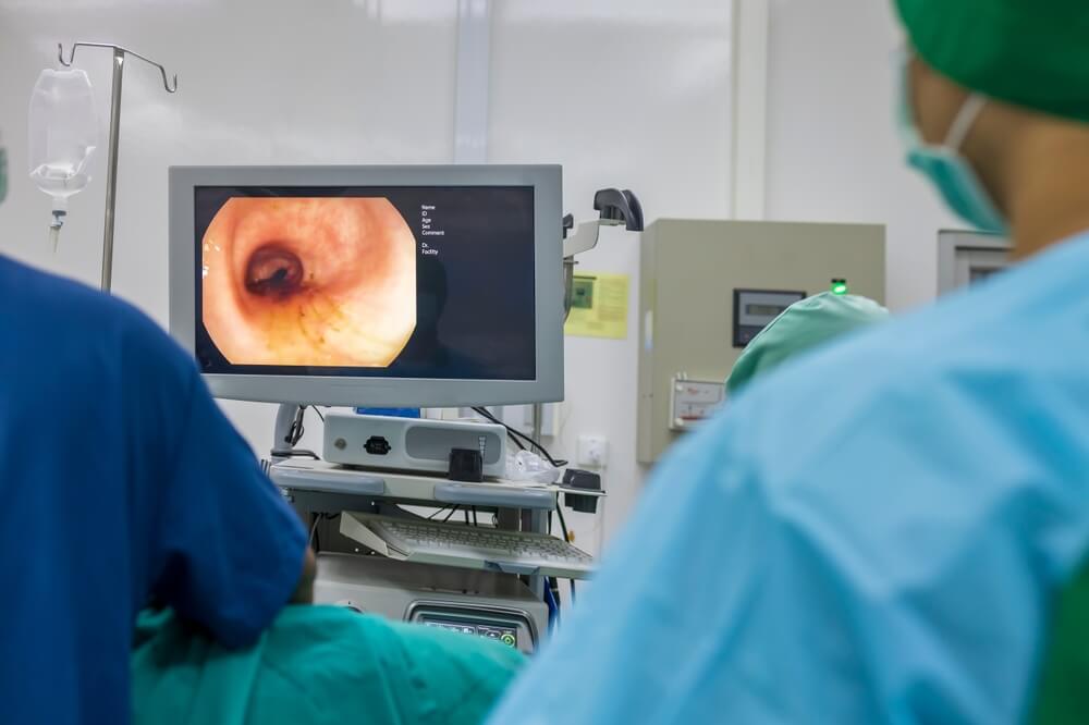 A doctor in a light blue protective gown did a colonoscopy inside operating theatre in the hospital.